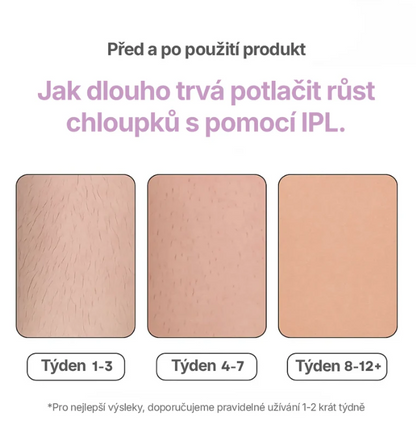 VELYSEA: IPL Laserový Odstraňovač Chloupků
